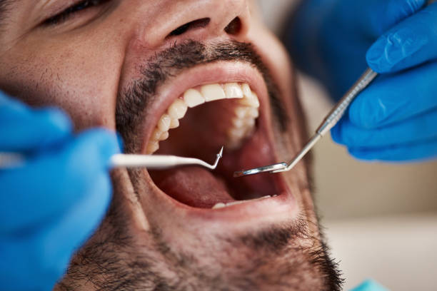 Best Laser Dentistry  in Lake Jackson, TX
